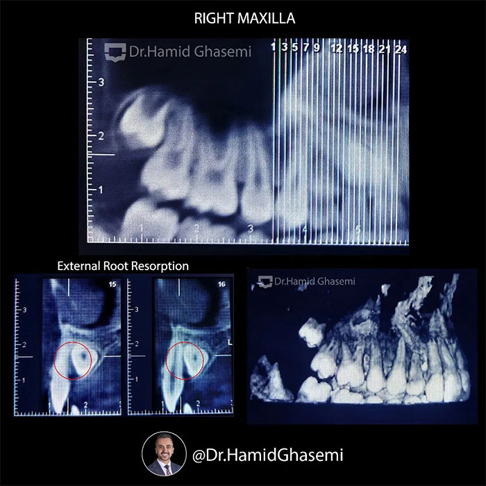 معصومه-صادقی-2