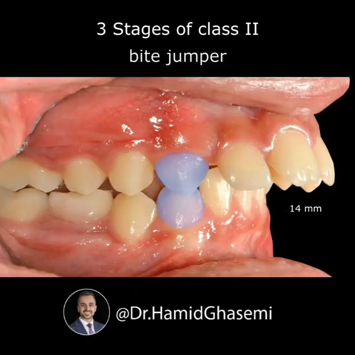 نمونه درمان ارتودنسی M.96_1135