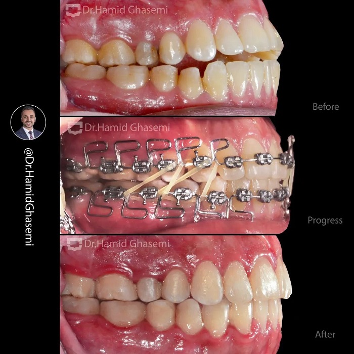 مهدیه آهنگرانی1