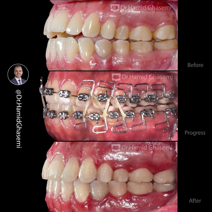مهدیه آهنگرانی2