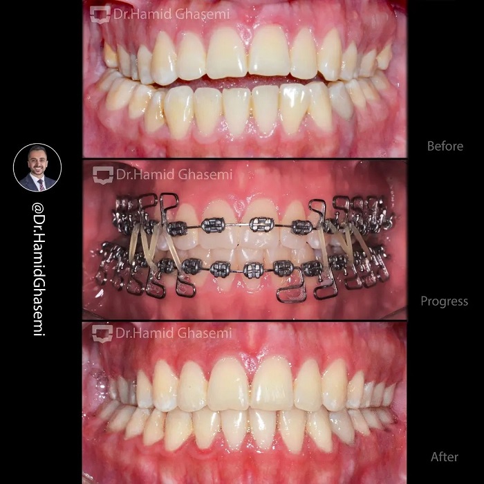 مهدیه آهنگرانی3