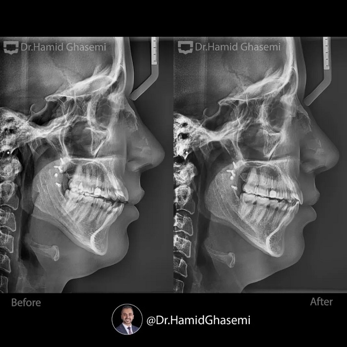 مهدیه آهنگرانی4
