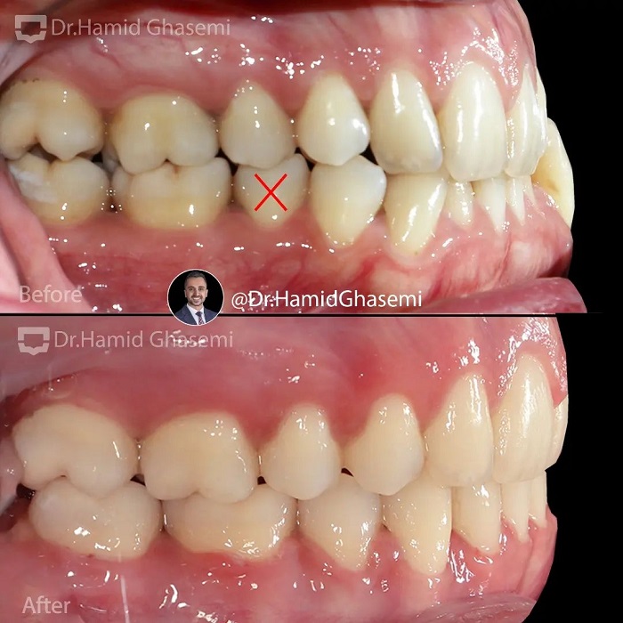 مهدیه تورانی2