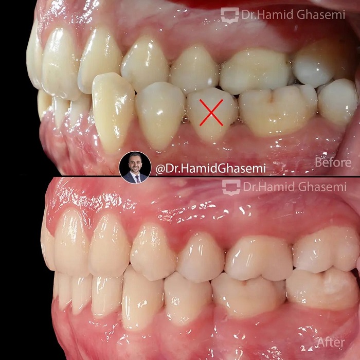 مهدیه تورانی3