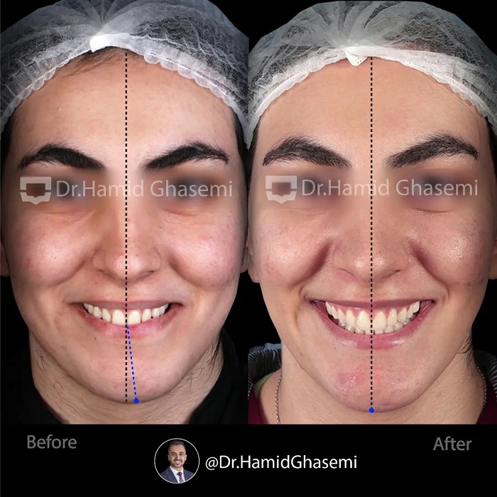 مهدیه تورانی4