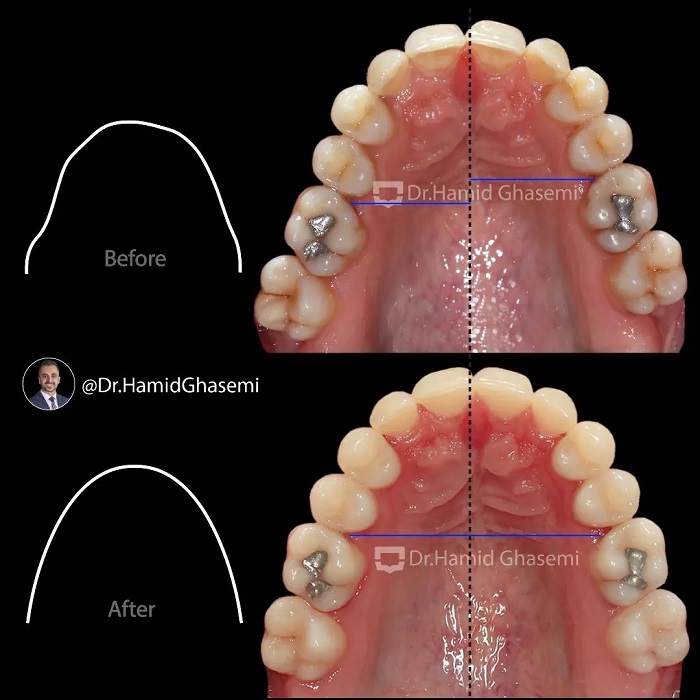 مهدیه تورانی5
