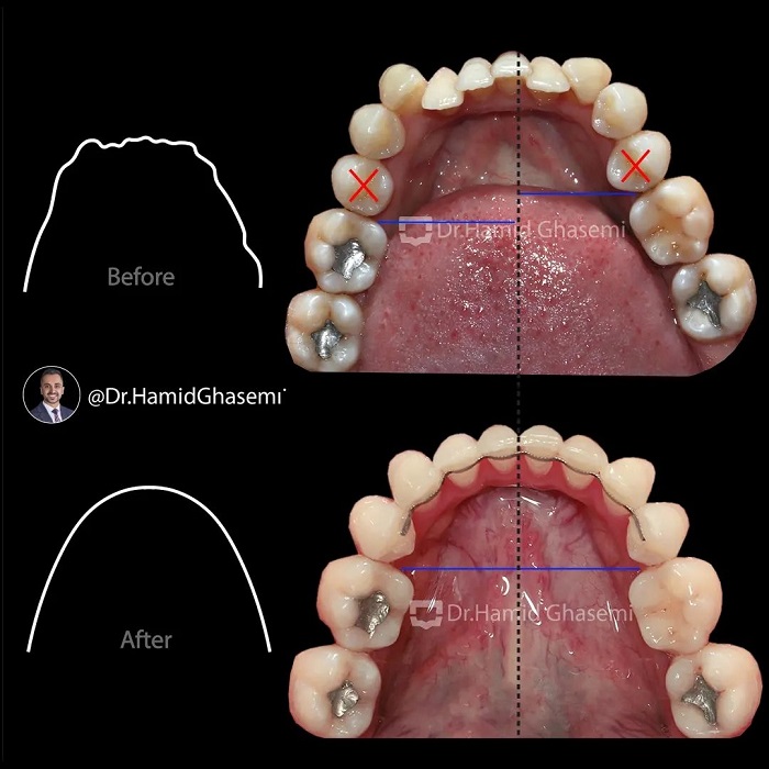 مهدیه تورانی6