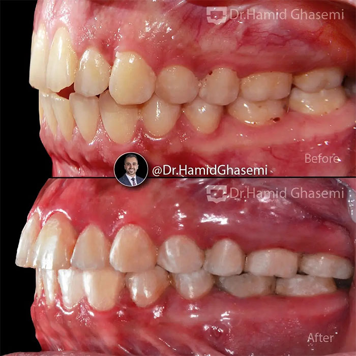 مهرناز-آجرلو-2