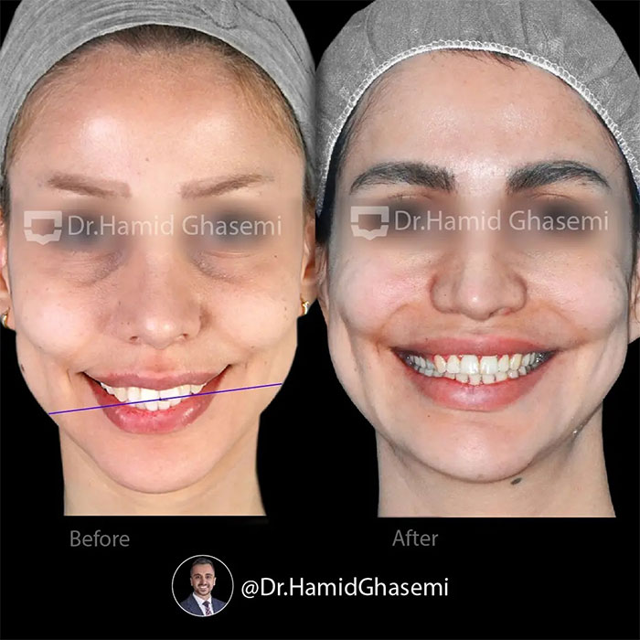 مهرناز-آجرلو-3