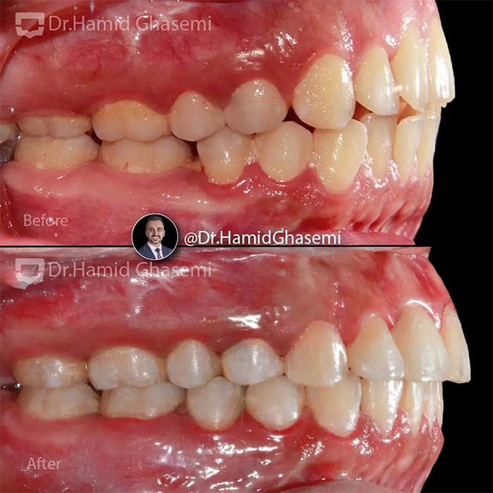 مهرناز-آجرلو-4