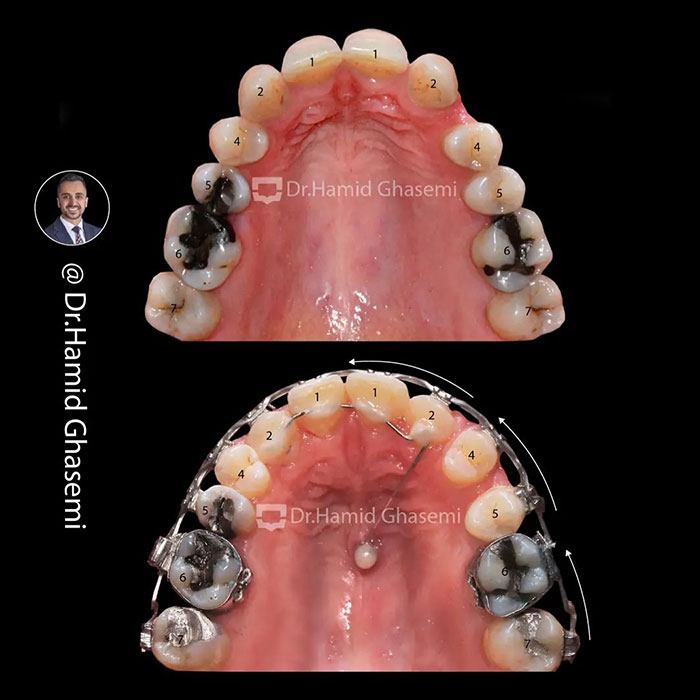 نمونه درمان ارتودنسی M.99_1730