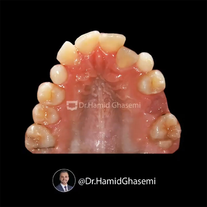 نمونه درمان ارتودنسی M. 00_1983