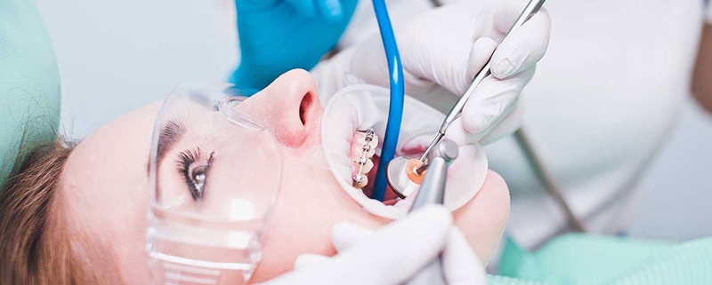 باندینگ ارتودنسی چیست؟