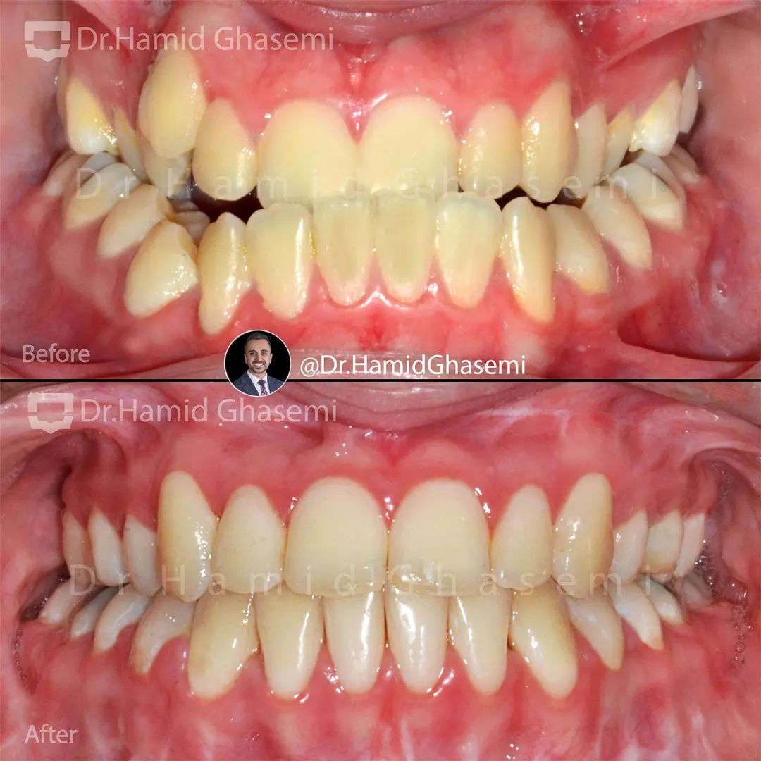 انتخاب متخصص ارتودنسی در کرج