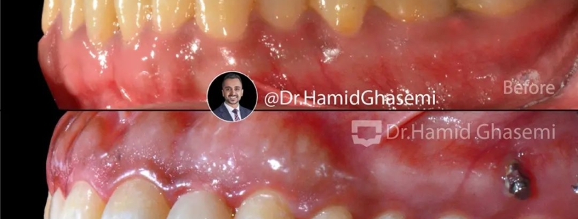 ارتودنسی مولتی لوپ در کرج