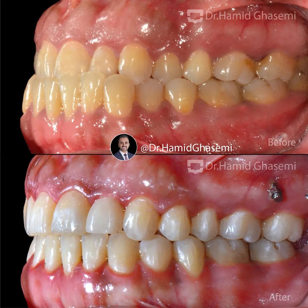 ارتودنسی مولتی لوپ در کرج