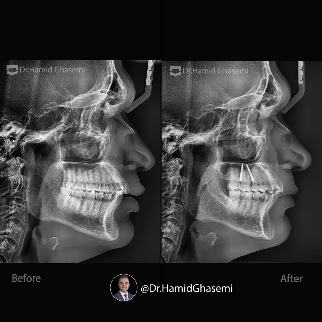 SnapInsta.to_471455250_590963083748629_7780866760030309497_n