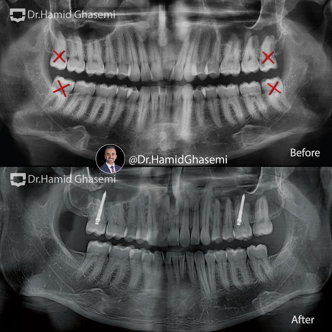 SnapInsta.to_472537123_2347805418914847_2364642404956117921_n