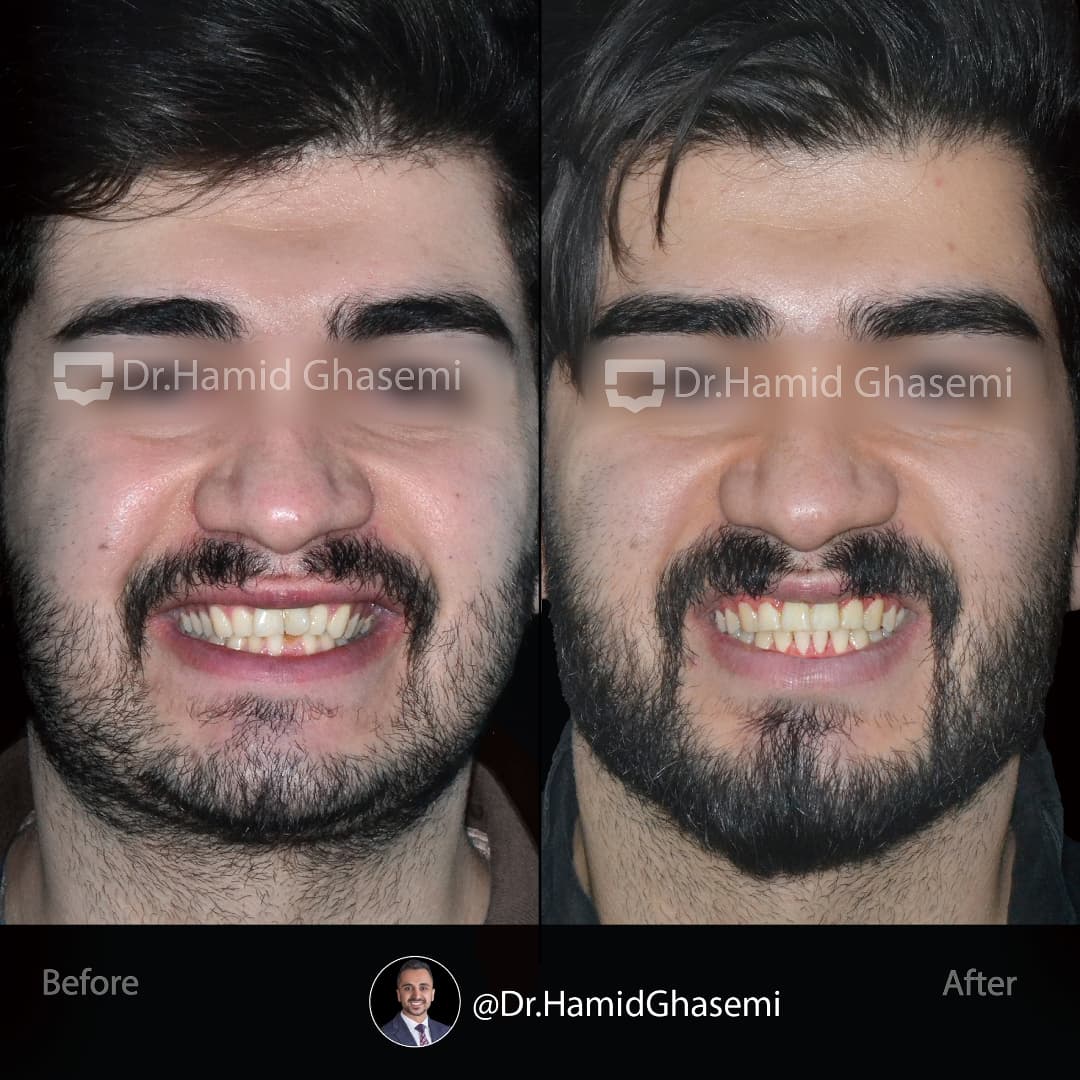 SnapInsta.to_472543943_1011523234148024_7310752224630252917_n