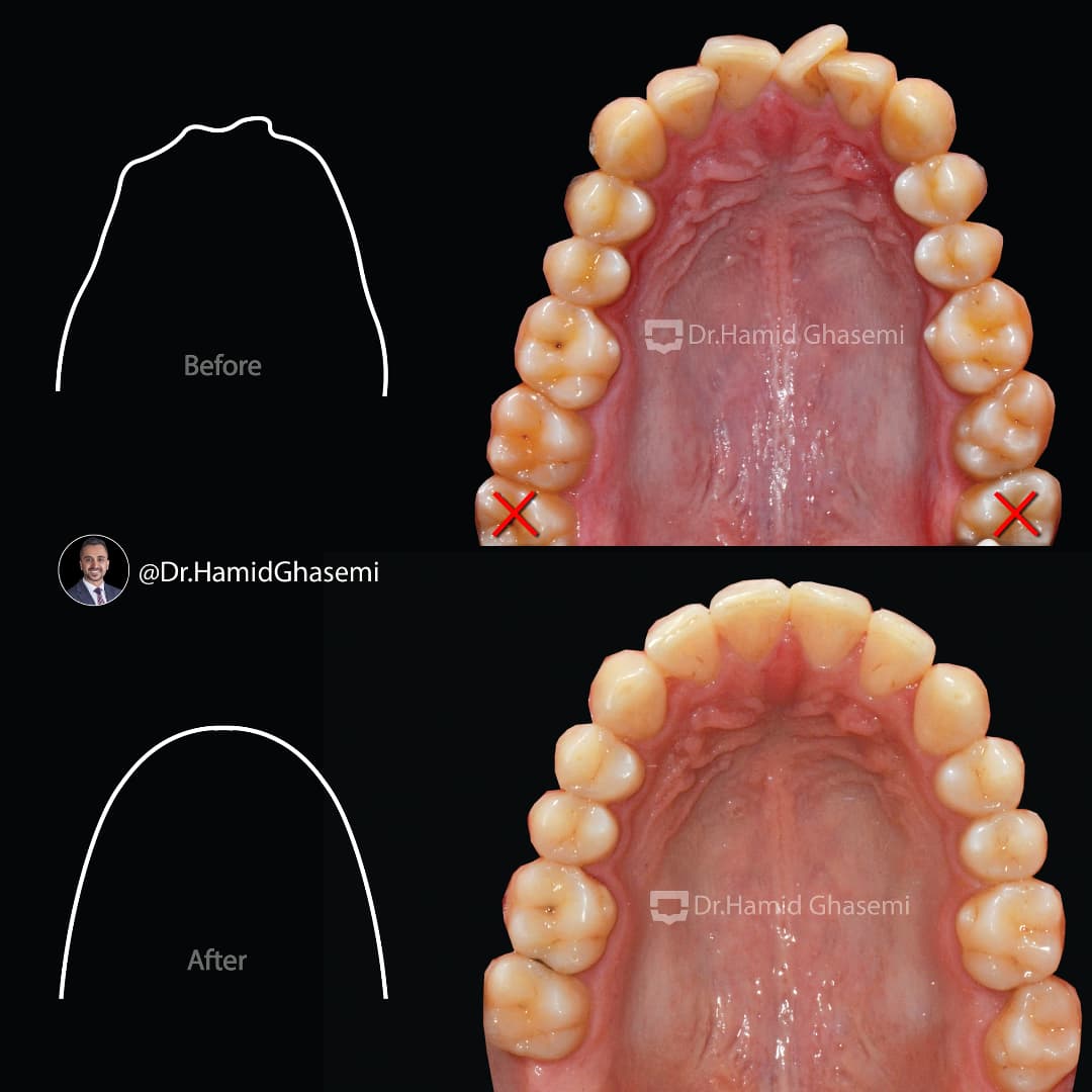 SnapInsta.to_472607000_483498778117245_4448053328903249760_n