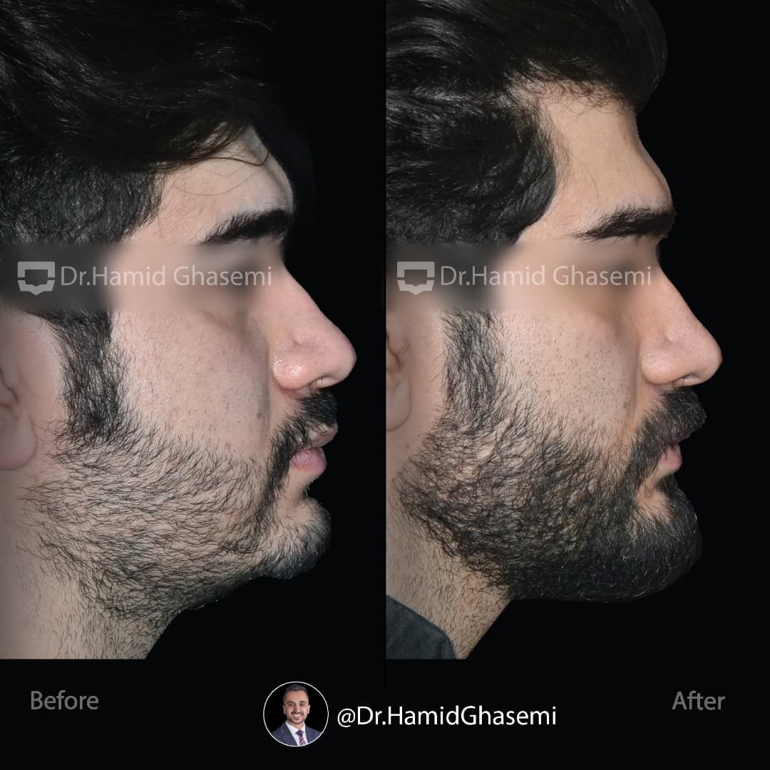 SnapInsta.to_472659131_636274495764536_468221258857899580_n