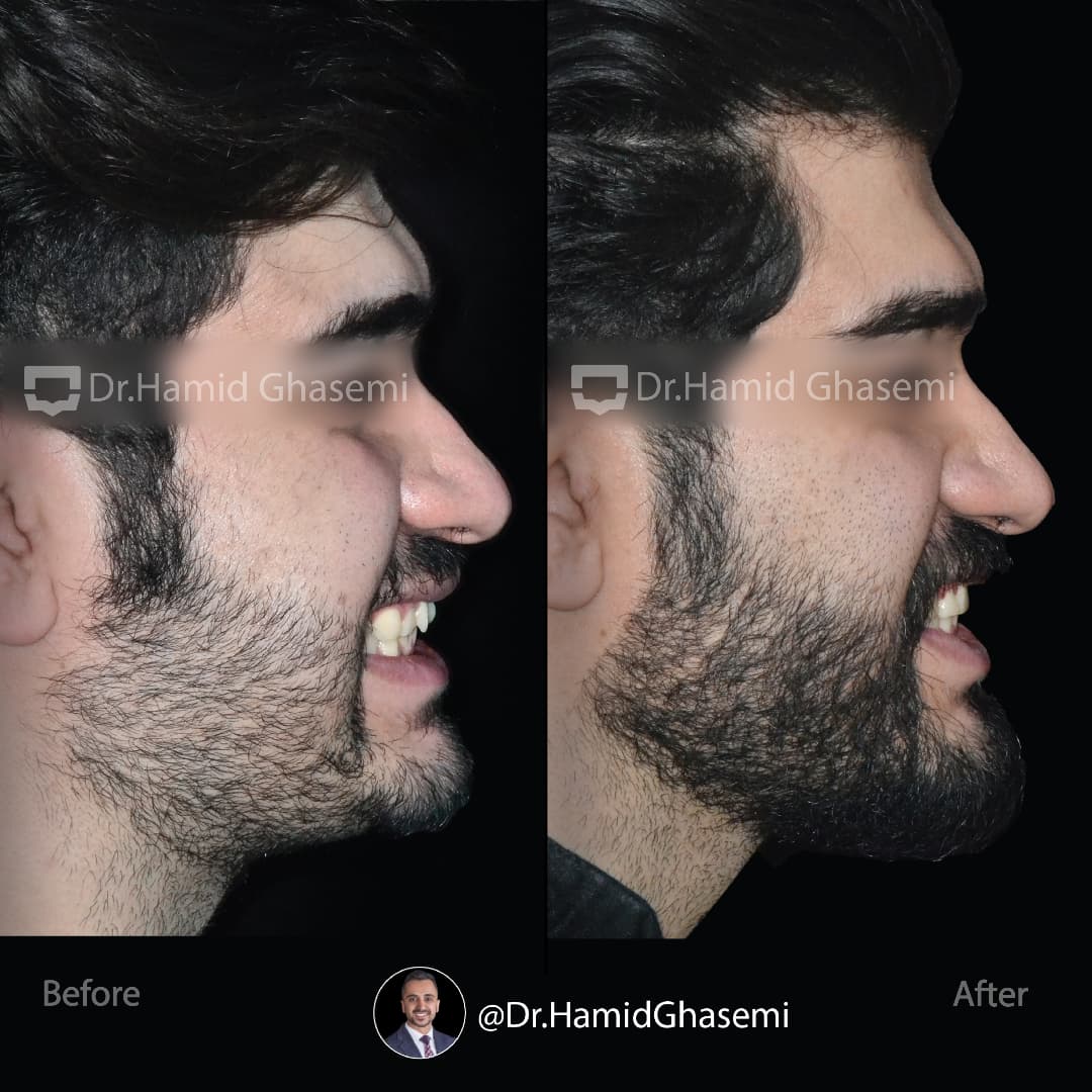 SnapInsta.to_472695998_625043536877129_5219665195923830679_n