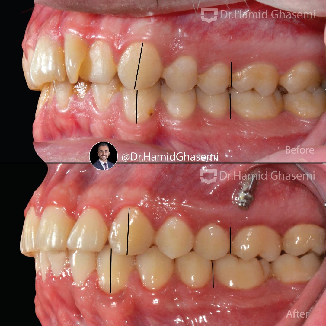 SnapInsta.to_473832993_1313700179783233_5332307006072960961_n