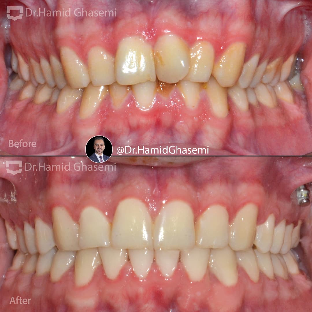 SnapInsta.to_473894686_486024330833966_2444708848394256063_n